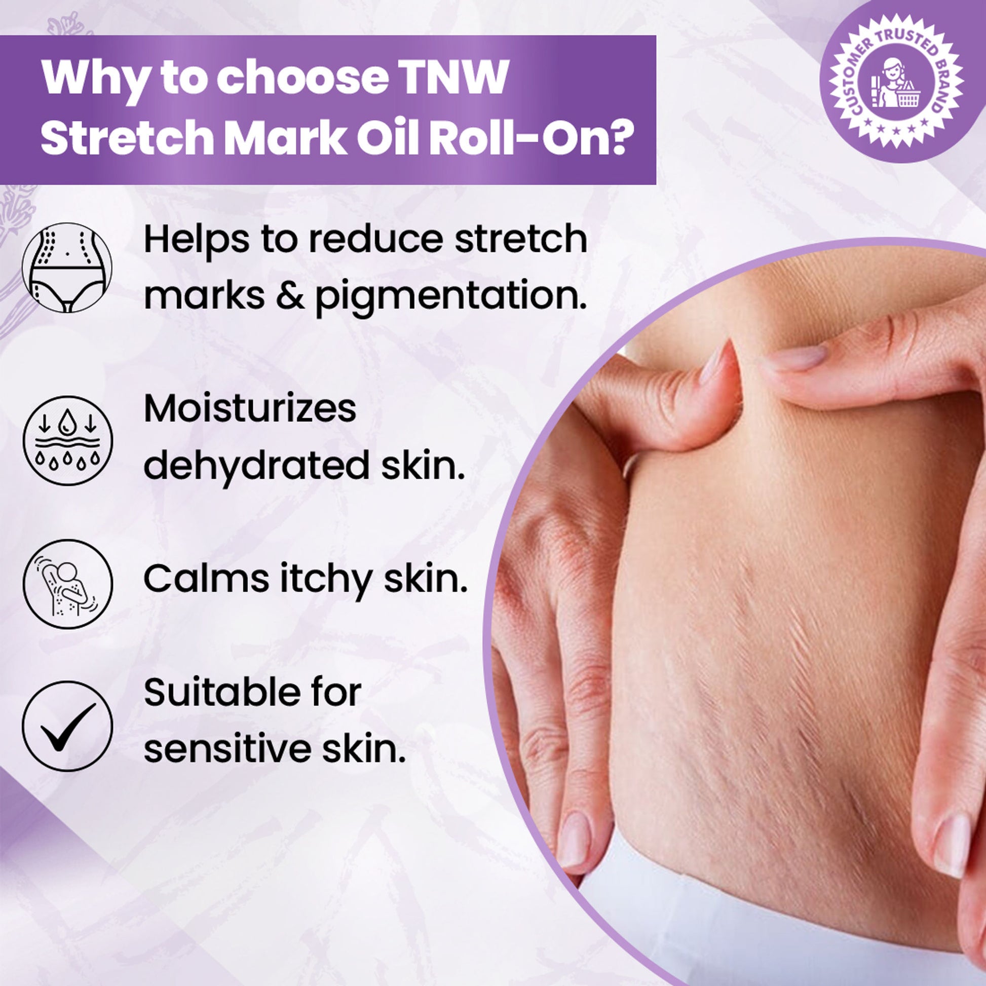 TNW The Natural Wash Stretch Mark Oil For Reducing Scars & Pigmentation