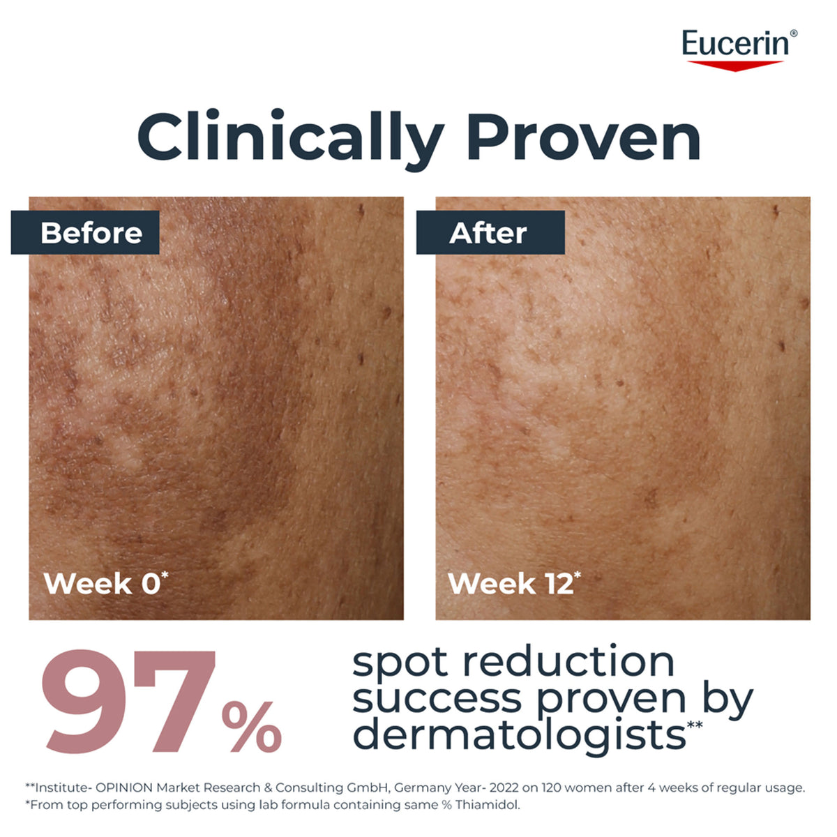 Eucerin Anti-Pigment Dual Serum With Thiamidol & Hyaluronic Acid , Reduces Dark Spots & Rejuvenates