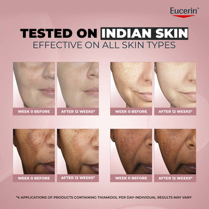 Eucerin Anti-Pigment Night Cream With Thiamidol Reduces Dark Spots & Night Regeneration