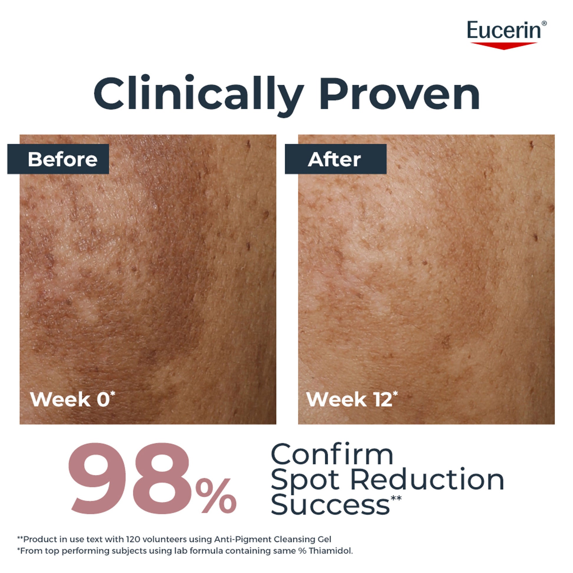 Eucerin Anti Pigment Cleansing Gel 2% Exfoliating AHA Complex