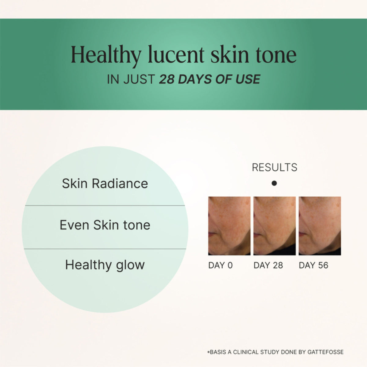 Oteria Sun Kissed Sun Care Gel With Aloe Vera Soothes Sun Damaged Skin, Suited For All Skin Types