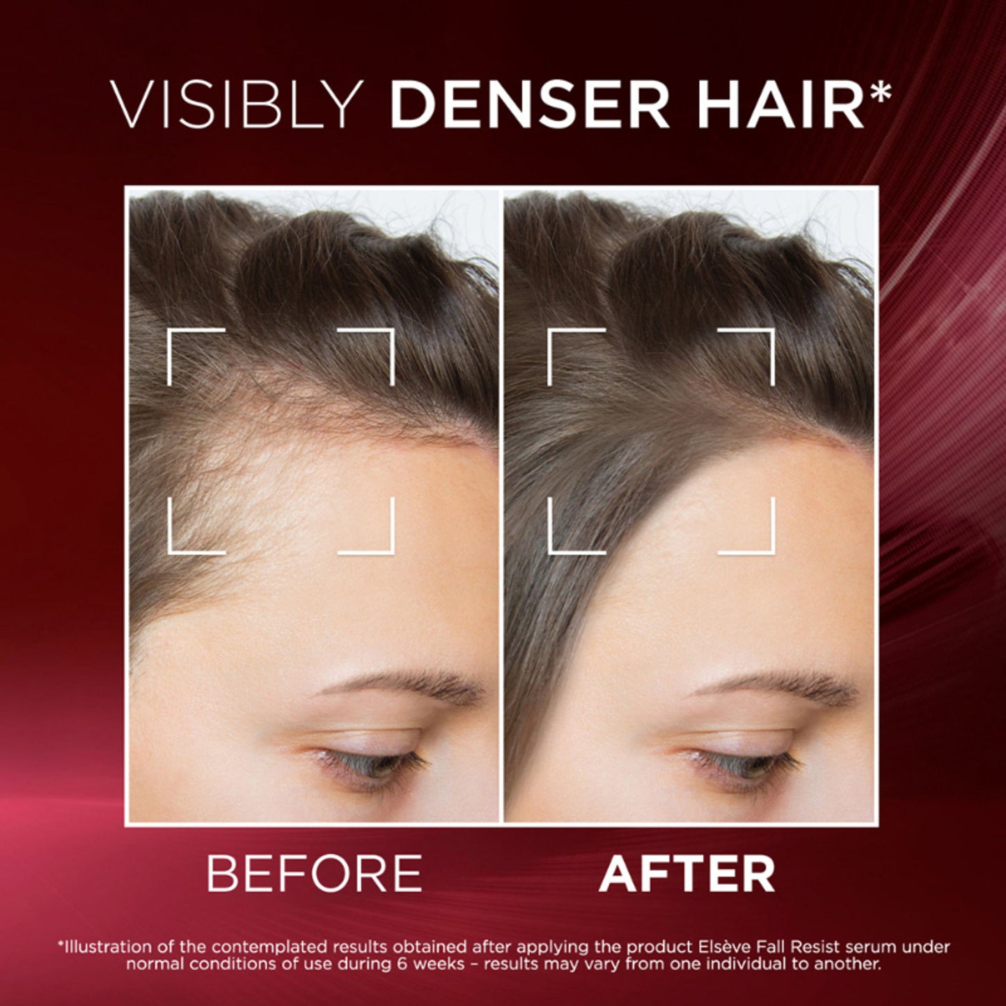 L'Oréal Paris Fall Resist Anti Hair Fall Serum with 1.5% Aminexil, Caffeine & Arginine.