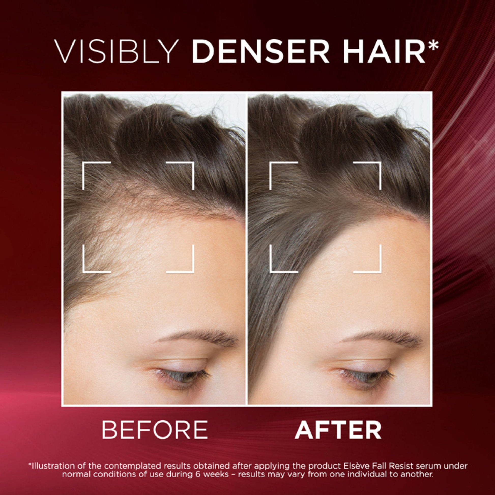 L'Oréal Paris Fall Resist Anti Hair Fall Serum with 1.5% Aminexil, Caffeine & Arginine.