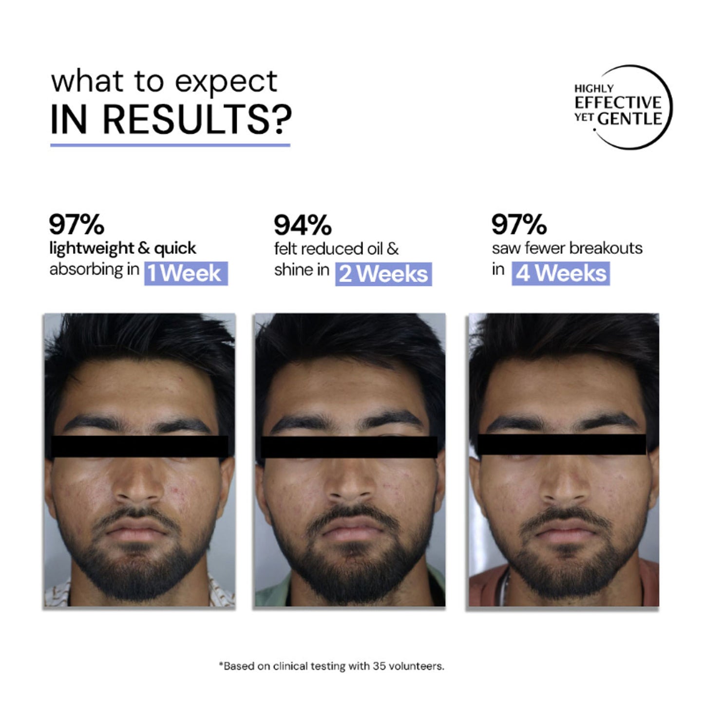 Deconstruct 3% Niacinamide & 2% Salicylic Acid Serum, Liposomal Technology, Controls Oil & Acne