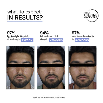 Deconstruct 3% Niacinamide & 2% Salicylic Acid Serum, Liposomal Technology, Controls Oil & Acne