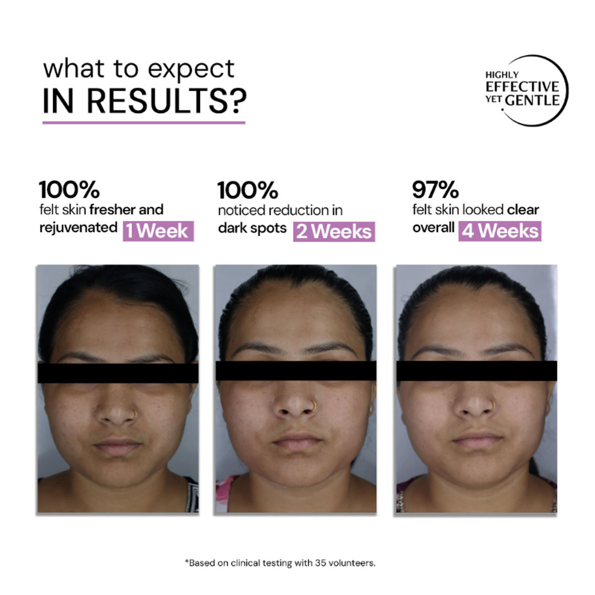 Deconstruct Exfoliating 18% AHA & 3% BHA PHA Serum Liposomal Technology for Face & Body Detan