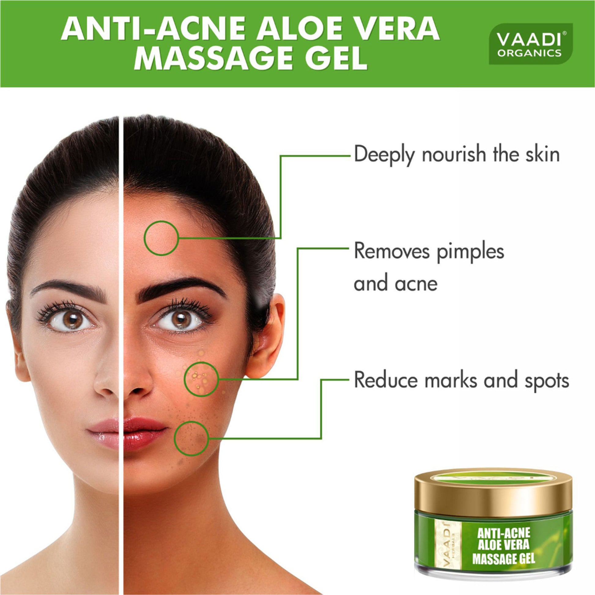 Vaadi Herbals Aloe Vera Anti Acne Massage Gel