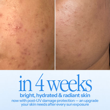 d'you Hustle Serum with 5% niacinamide, hyaluronic acid, and vitamin C for acne and pigmentation treatment.
