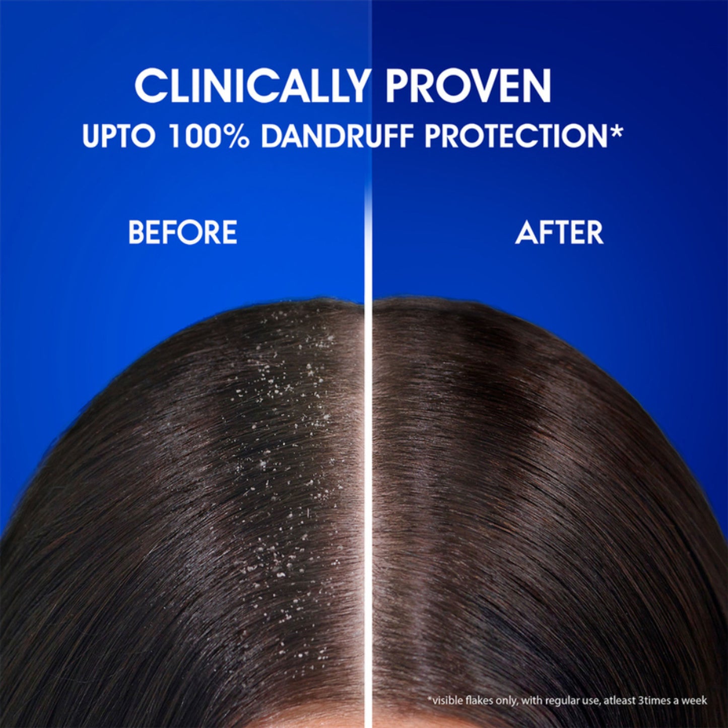 Head & Shoulders Anti Hair Fall Shampoo