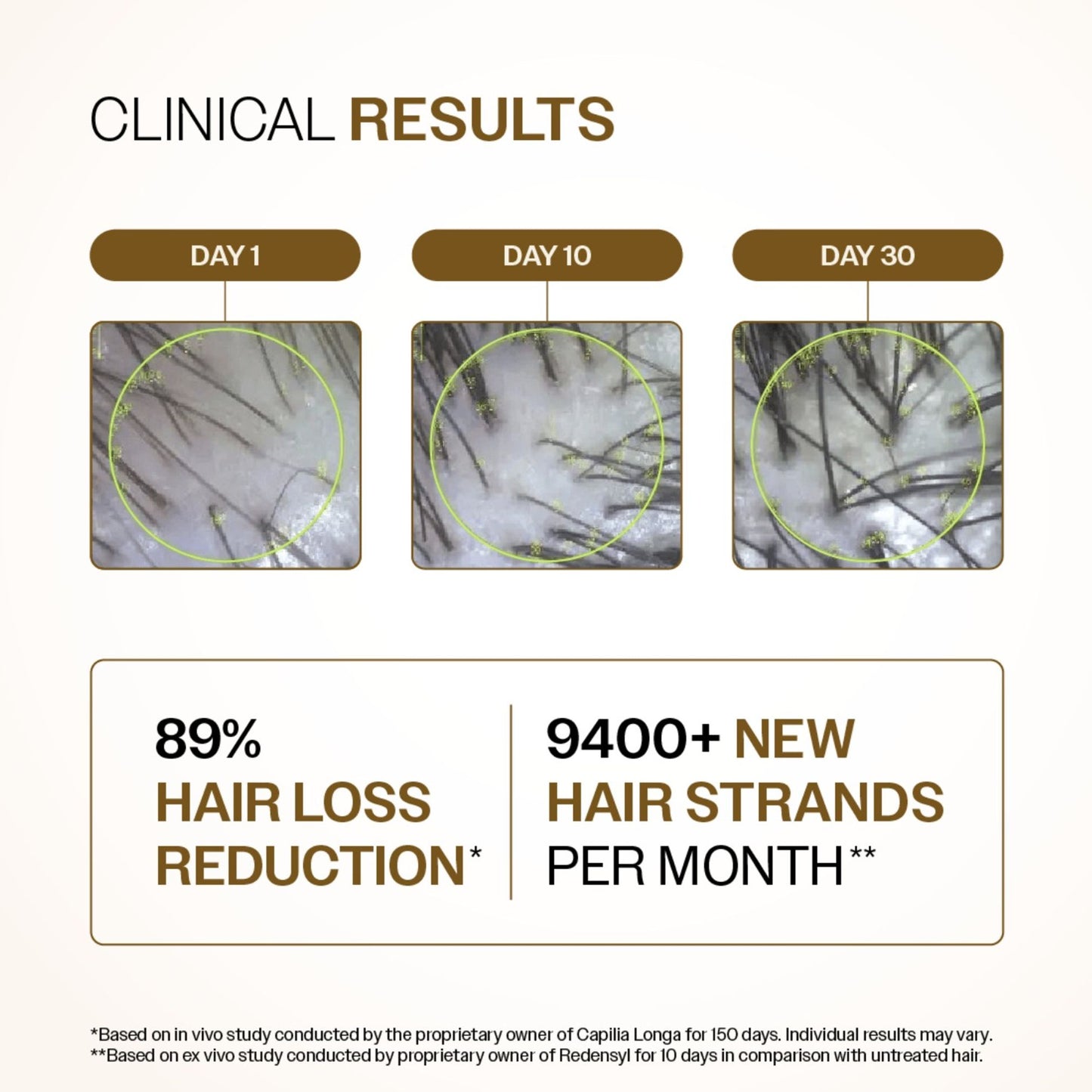 Bare Anatomy Advanced Hair Growth Serum - 3% Redensyl + 4% Anagain + Rosemary + Rice Water