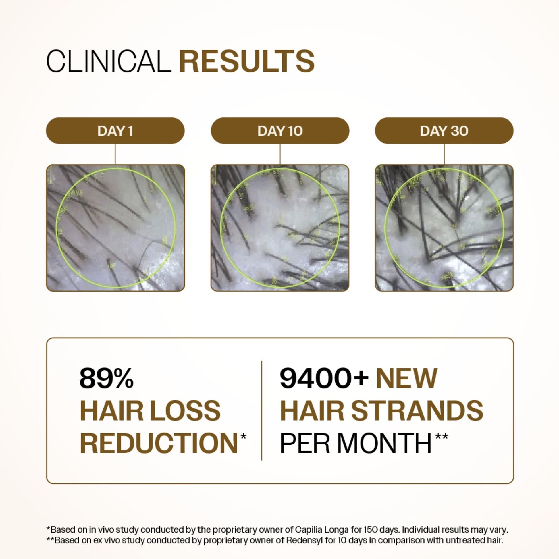 Bare Anatomy Advanced Hair Growth Serum - 3% Redensyl + 4% Anagain + Rosemary + Rice Water