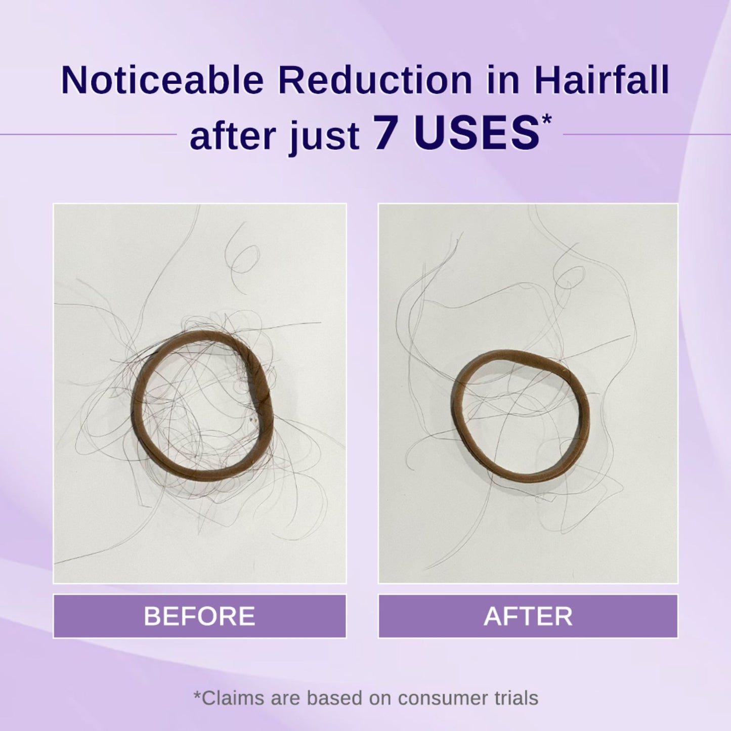 Bare Anatomy Rosemary Hibiscus Hair Growth Oil | Nourishes, Strengthens & Controls Hair Fall