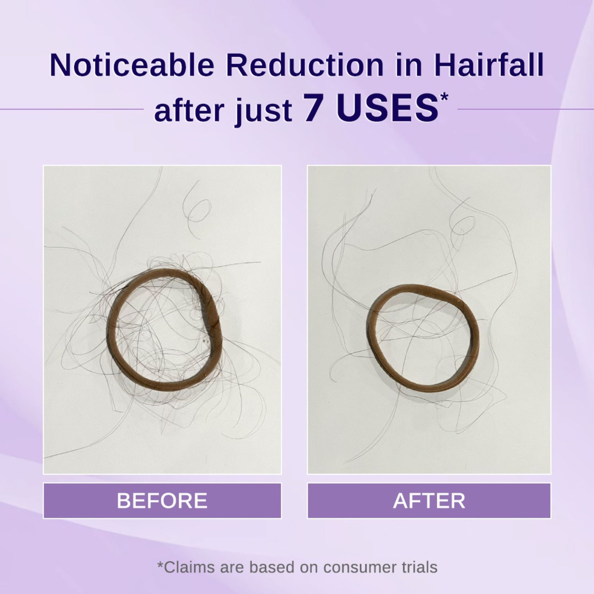 Bare Anatomy Rosemary Hibiscus Hair Growth Oil | Nourishes, Strengthens & Controls Hair Fall