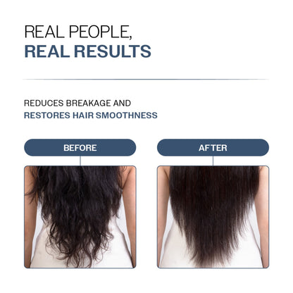 Bare Anatomy Anti-Hair Fall Conditioner for Hair Fall & Thinning with Redensyl + Rosemary
