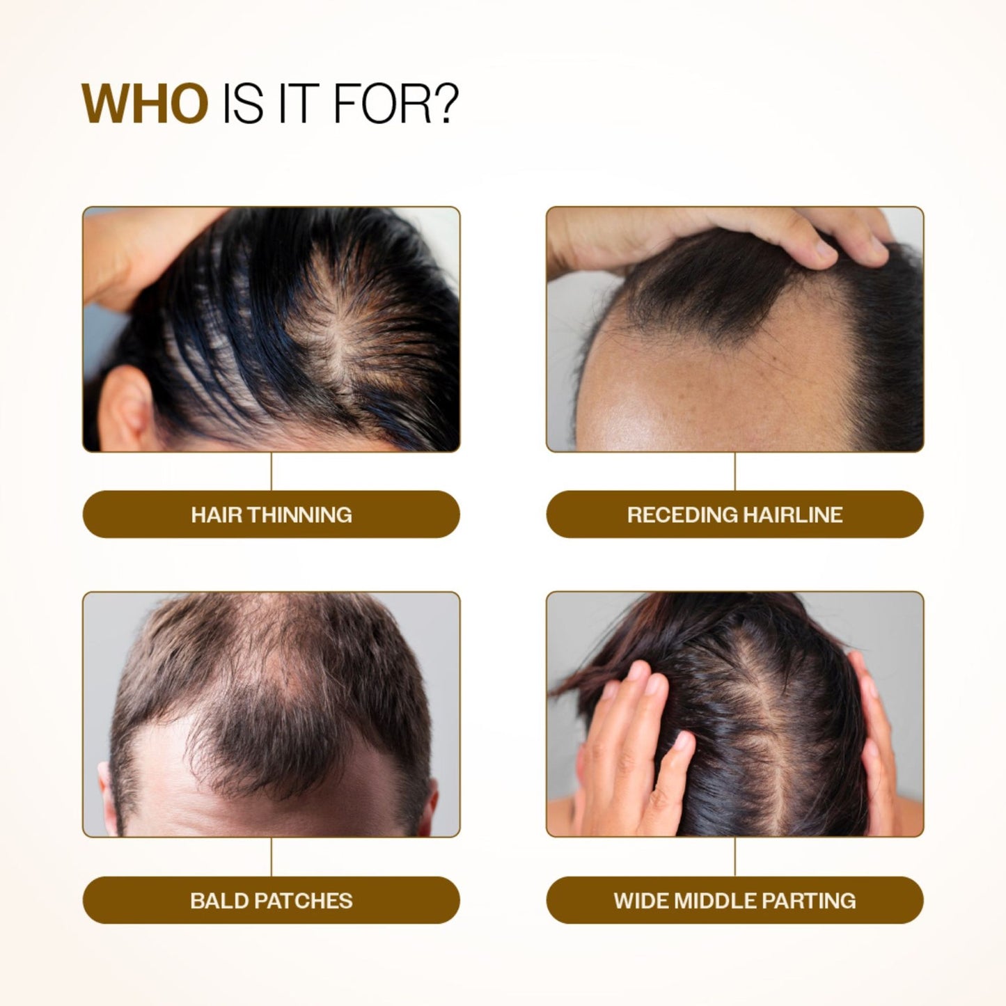 Bare Anatomy Advanced Hair Growth Serum - 3% Redensyl + 4% Anagain + Rosemary + Rice Water