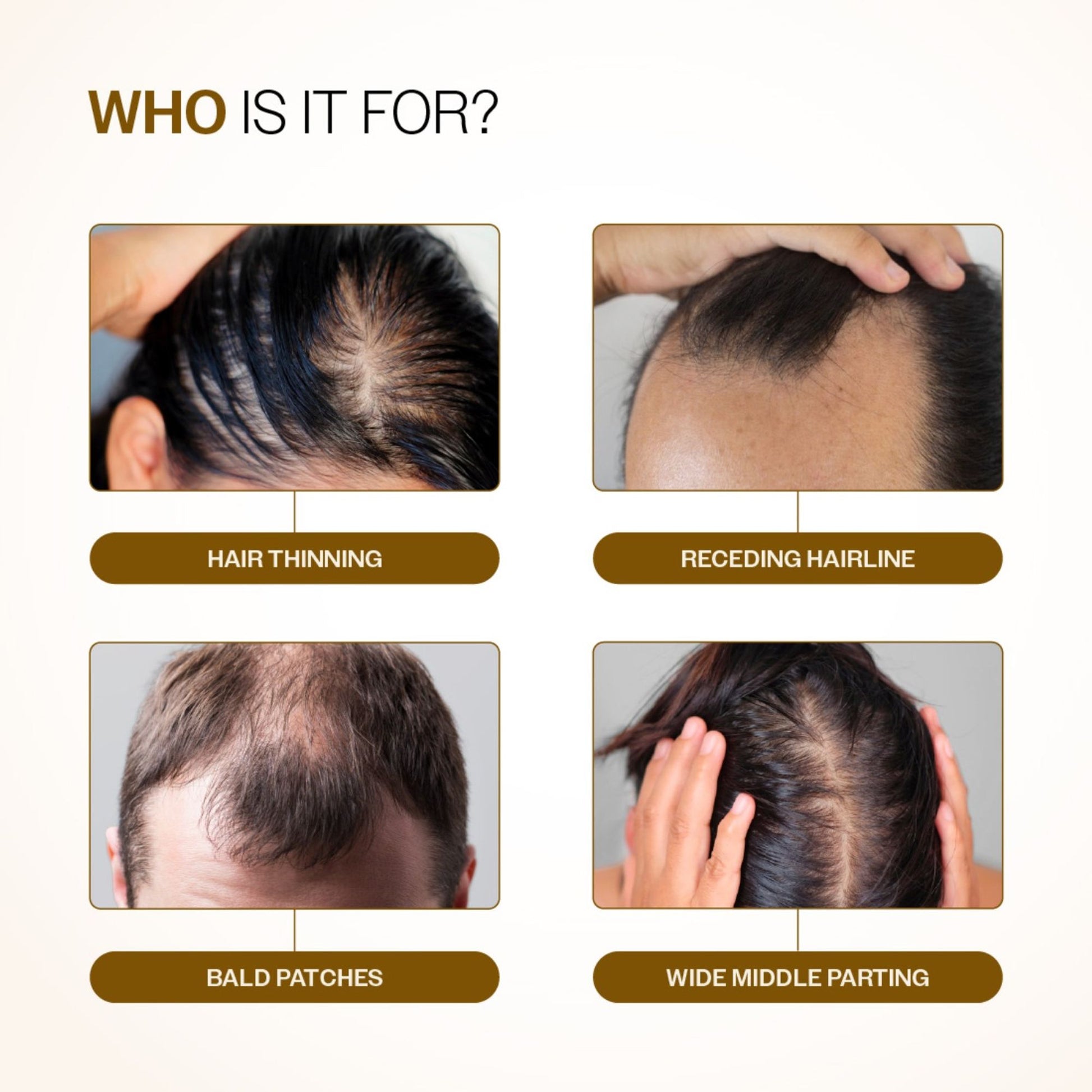 Bare Anatomy Advanced Hair Growth Serum - 3% Redensyl + 4% Anagain + Rosemary + Rice Water