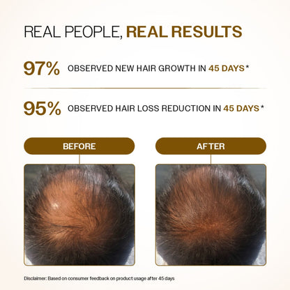 Bare Anatomy Advanced Hair Growth Serum - 3% Redensyl + 4% Anagain + Rosemary + Rice Water