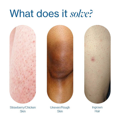 Be Bodywise 7% Glycolic Acid Stick Body Exfoliation For Smooth, Clear & Even Skin