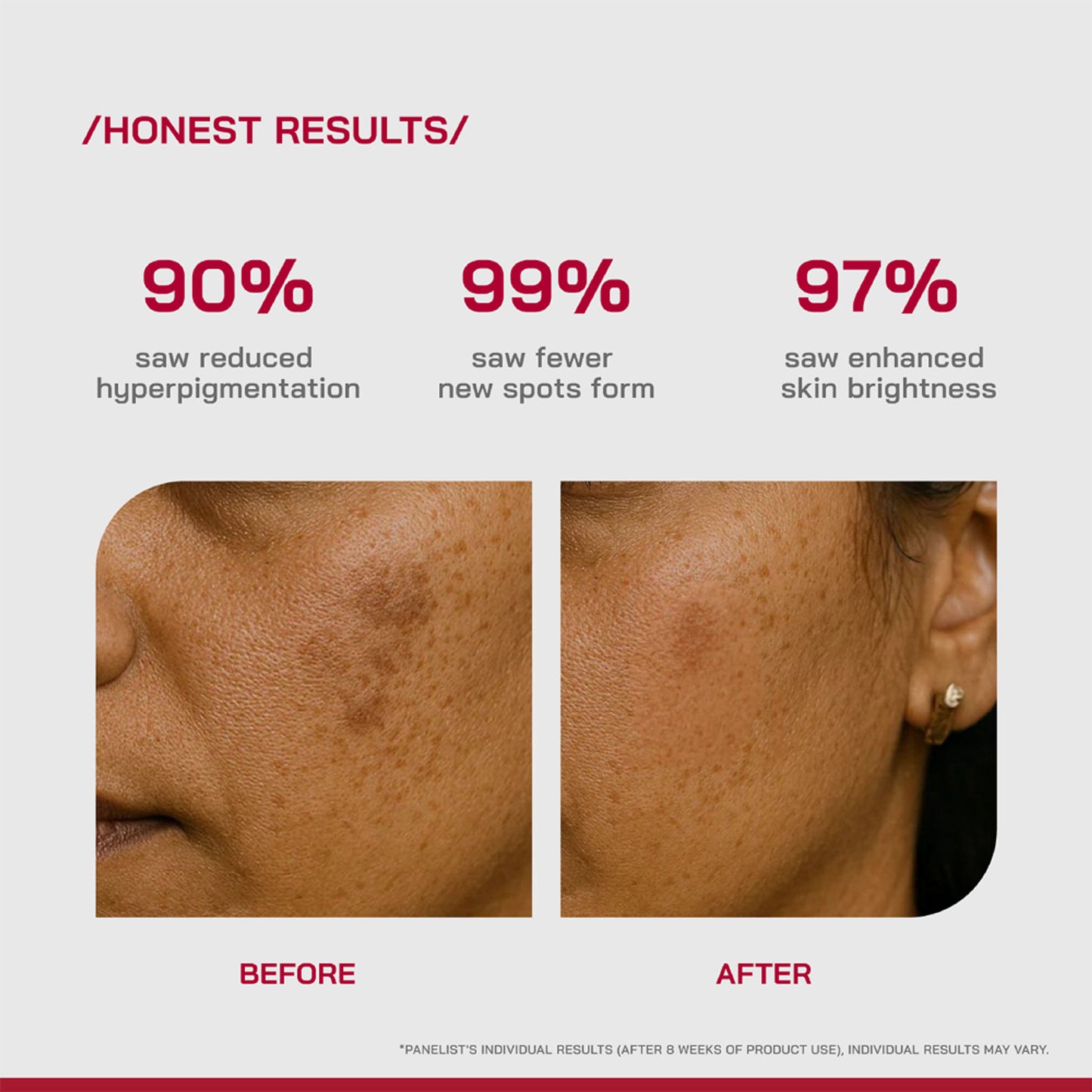 Proven Honest Derma PHD 2% Alpha Arbutin Serum