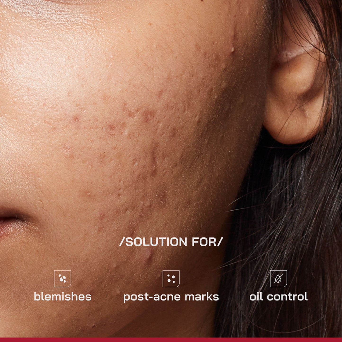 Proven Honest Derma PHD 10% Niacinamide Spot Correcting Serum