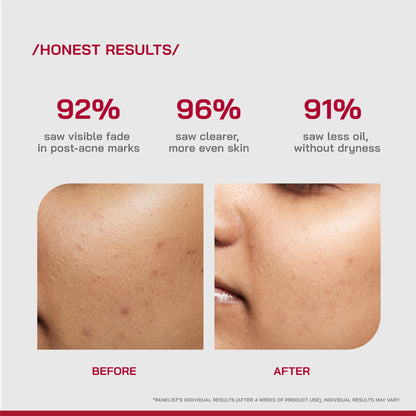 Proven Honest Derma PHD 10% Niacinamide Spot Correcting Serum