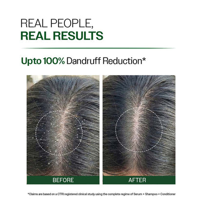 Bare Anatomy Anti-Dandruff Shampoo with Salicylic Acid, Piroctone Olamine, Biotin & Menthol