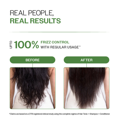 Bare Anatomy Anti-Dandruff Conditioner with Rosemary & Biotin, Moisturizes & Reduces Frizz