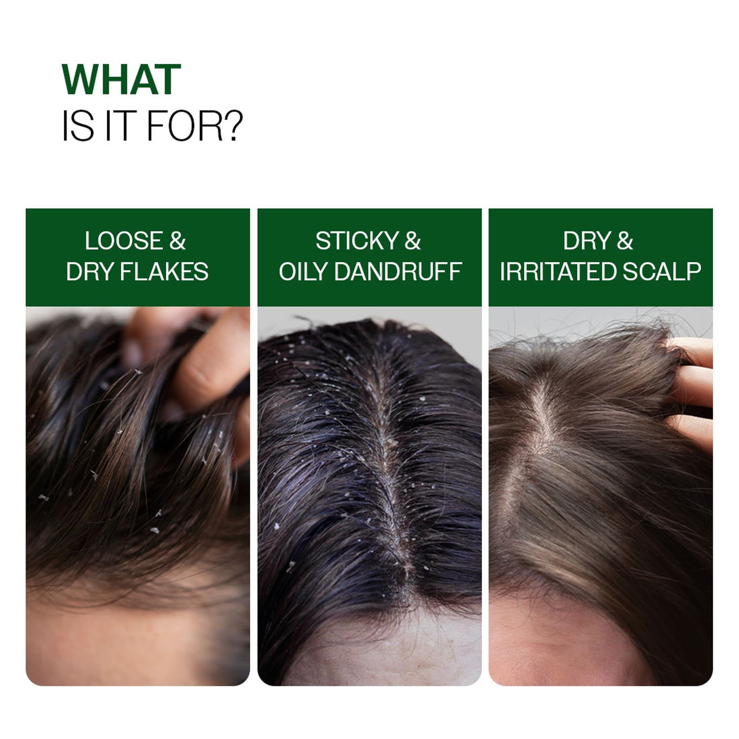 Bare Anatomy Advanced Anti Dandruff Serum Up to 100% Dandruff Reduction Non-Greasy Formula