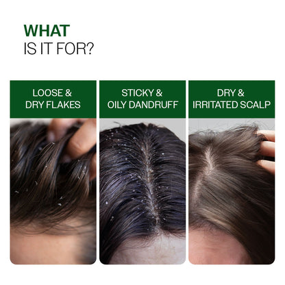 Bare Anatomy Advanced Anti Dandruff Serum Up to 100% Dandruff Reduction Non-Greasy Formula
