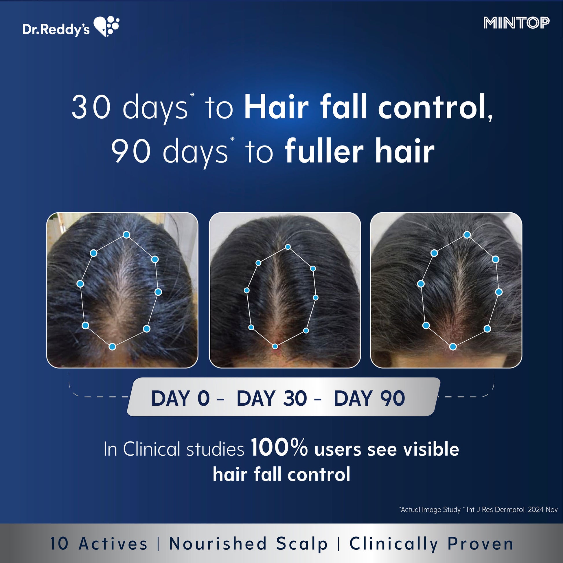 Mintop Pro Plus Hair Regrowth Serum