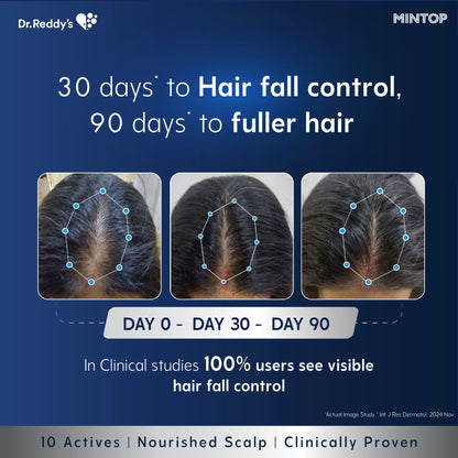 Mintop Pro Plus Hair Regrowth Serum