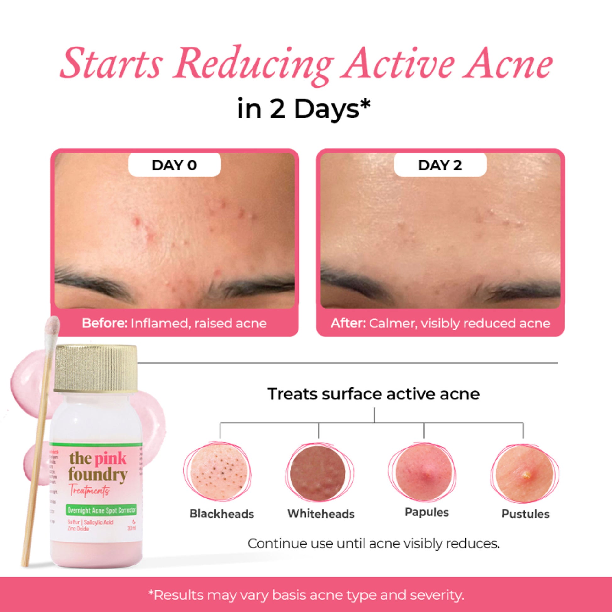 The Pink Foundry Overnight Acne Spot Corrector
