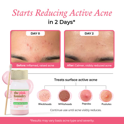 The Pink Foundry Overnight Acne Spot Corrector