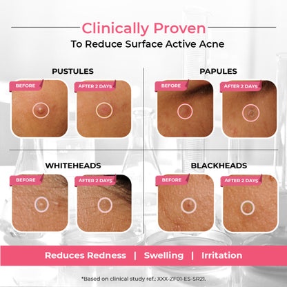 The Pink Foundry Overnight Acne Spot Corrector