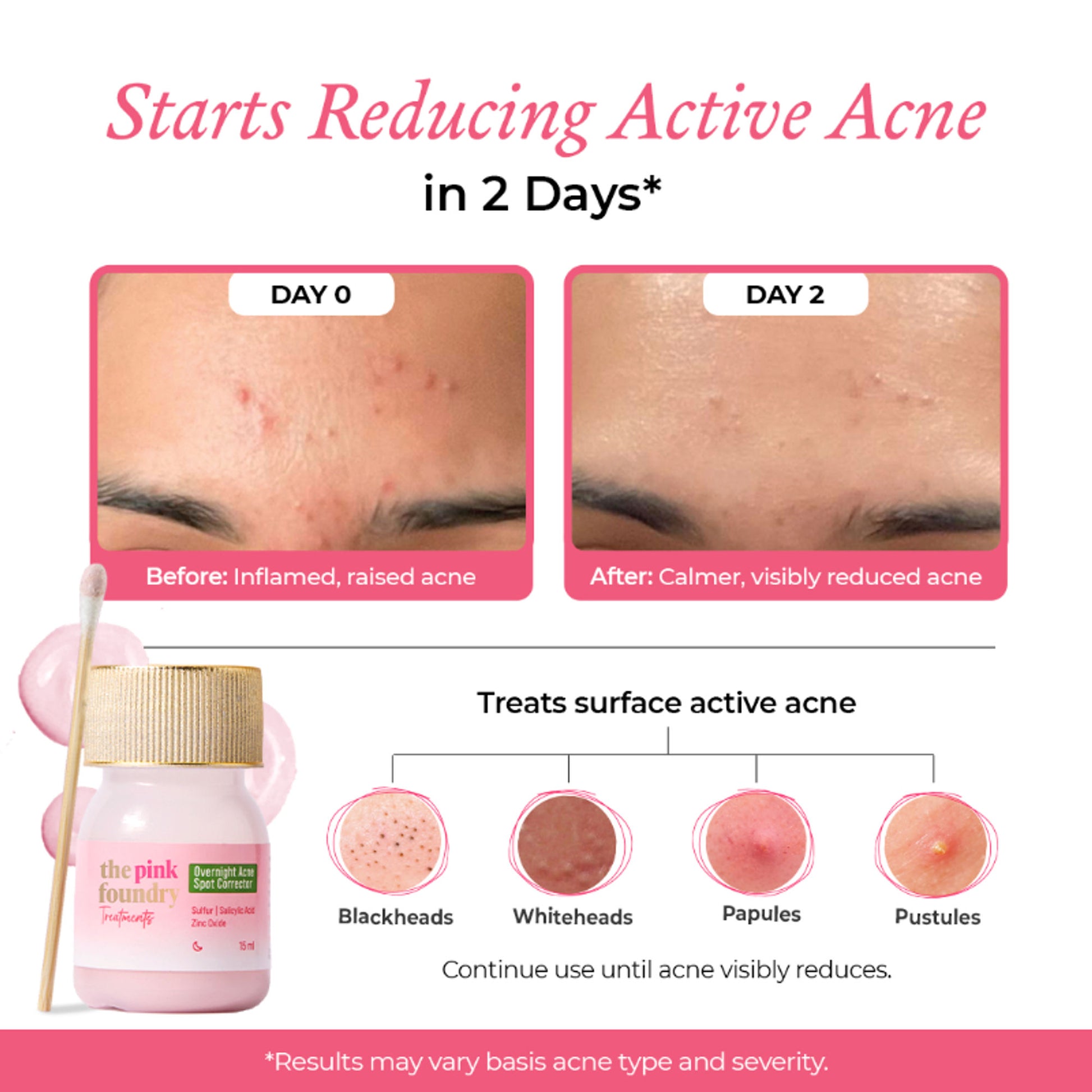 The Pink Foundry Overnight Acne Spot Corrector