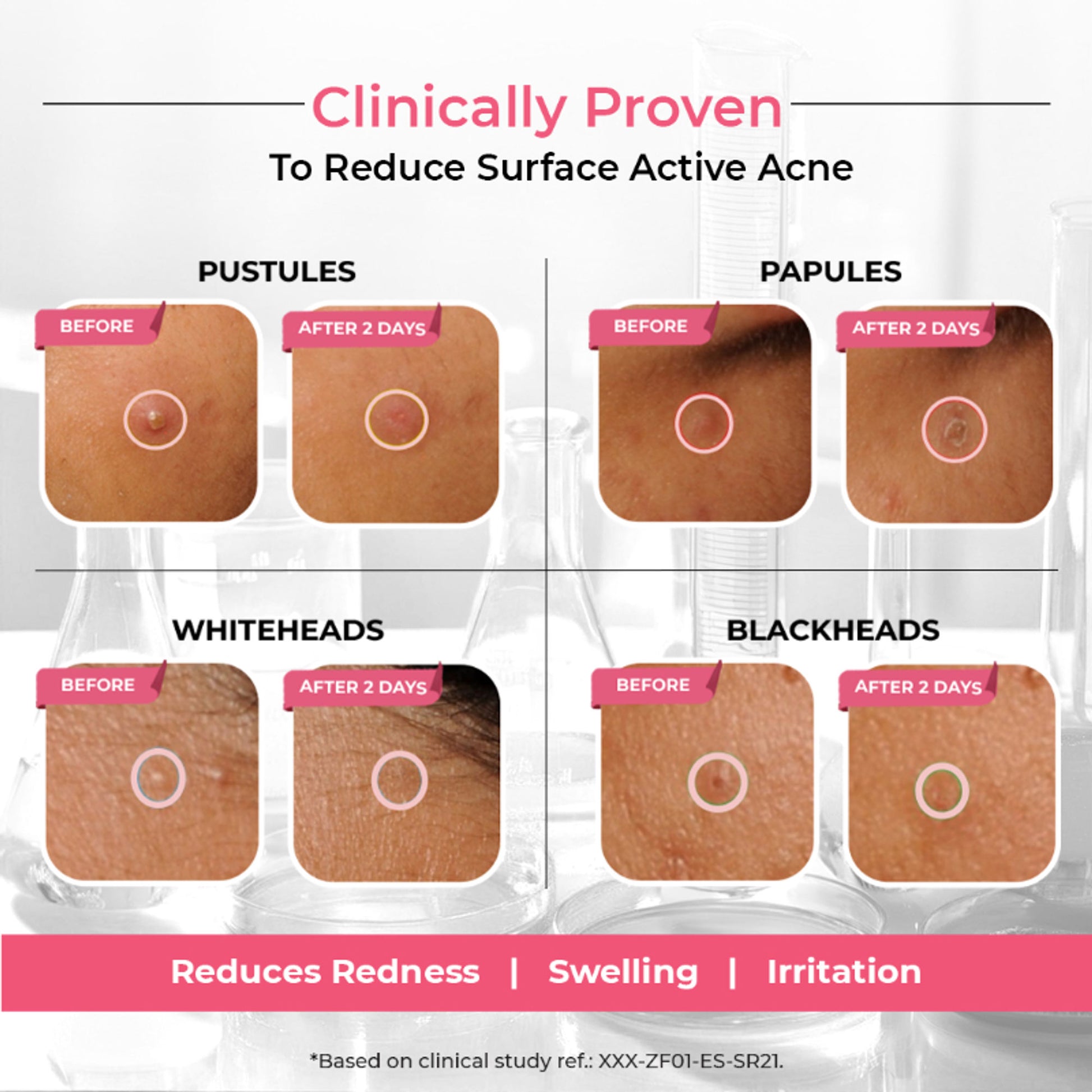 The Pink Foundry Overnight Acne Spot Corrector