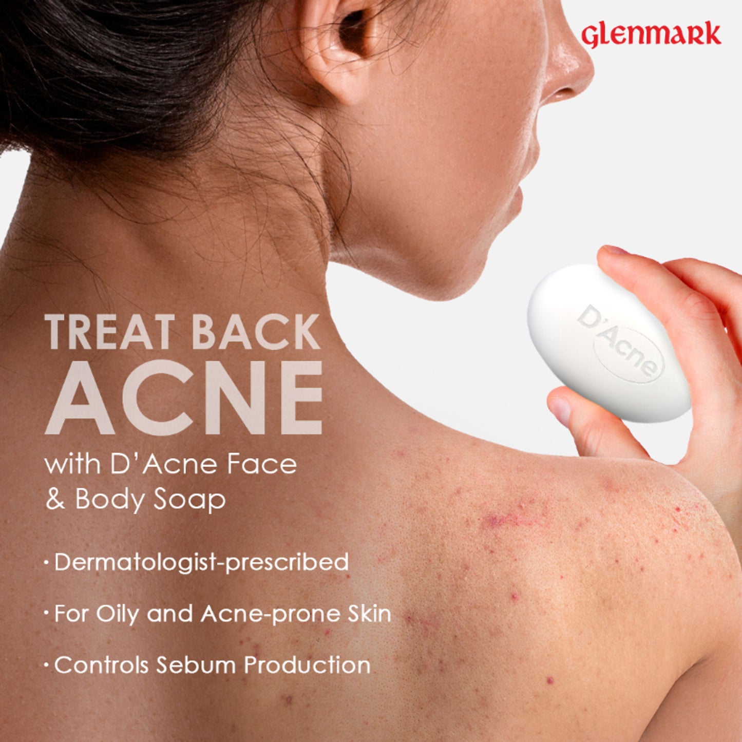 D'Acne Body & Face Soap for Acne-Prone and Oily Skin, Visible Acne Reduction in 10 Days