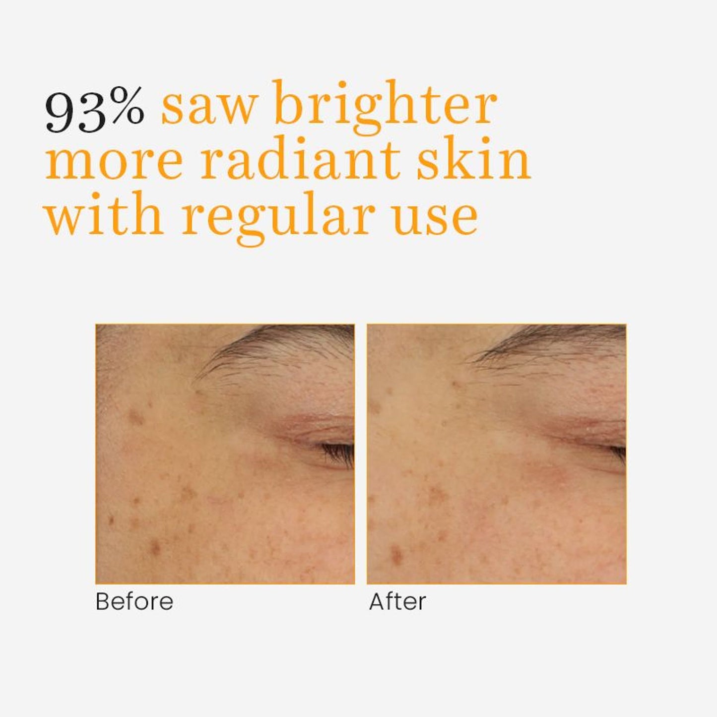 O3+ Vitamin- C & Turmeric Gel Cream For Glow And Moisturised Skin