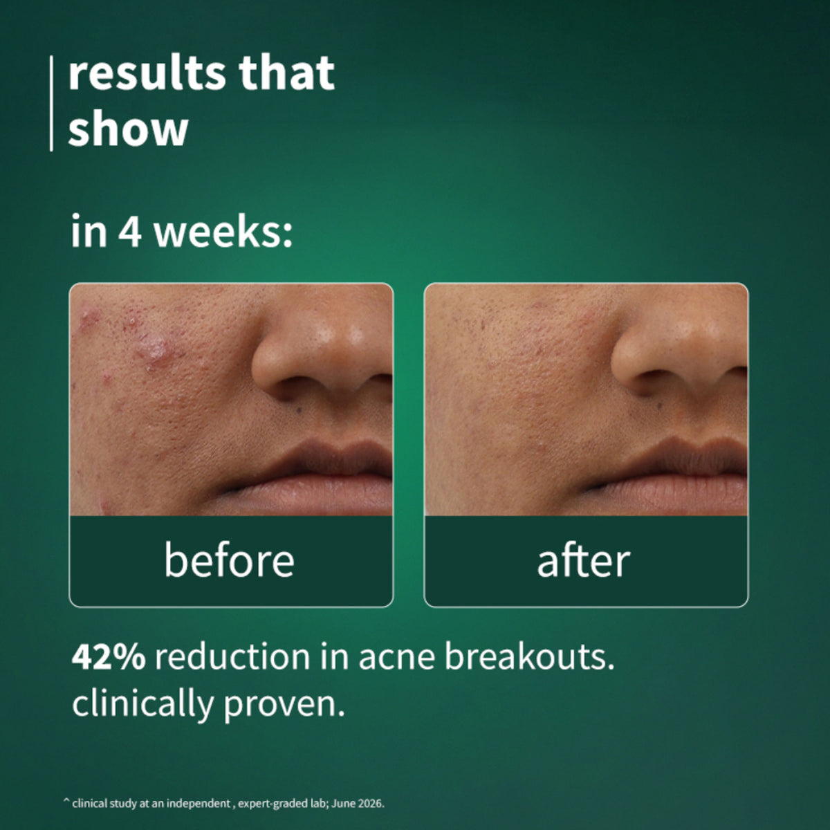 Plum SebaclearTM Mattifying Gel Crème With Matcha & Sebacic Acid