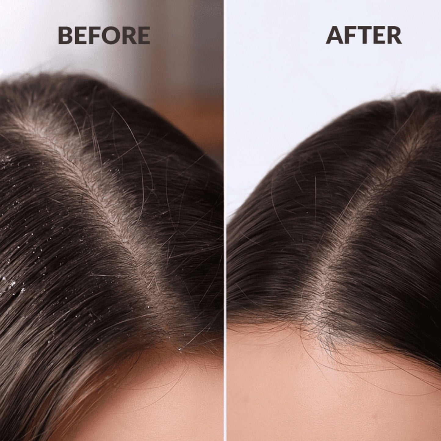 Beauty Garage Scalp Sense Hydra Soothe Shampoo