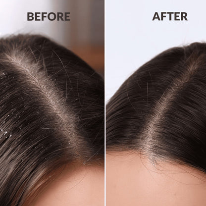 Beauty Garage Scalp Sense Hydra Soothe Shampoo