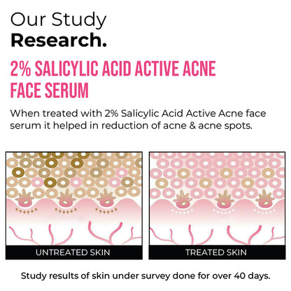 Insight Cosmetics 2% Salicylic Acid Active Acne Face Serum