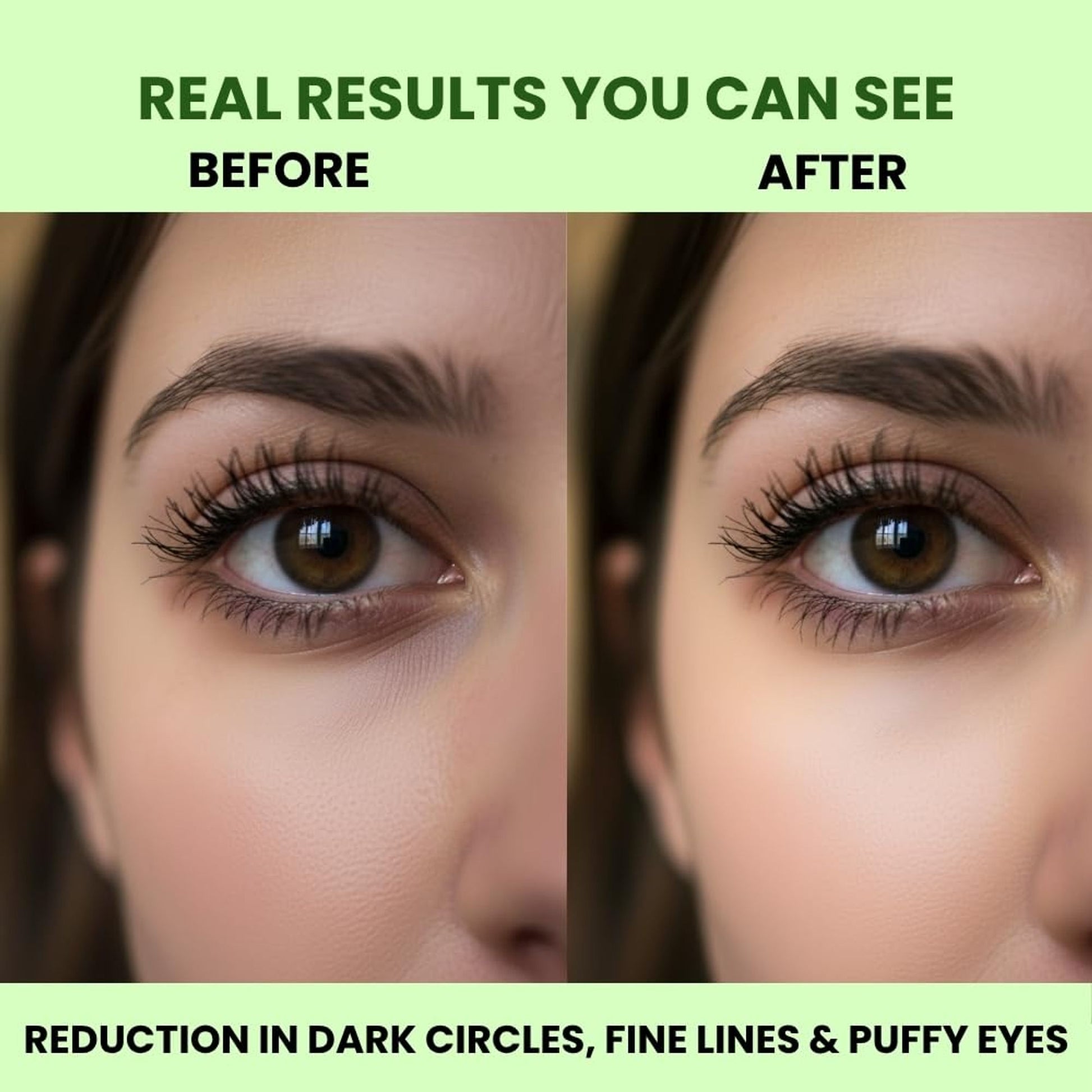 Carbamide Forte Under Eye Patches, Reduces Dark Circles, Puffiness & Fine Lines