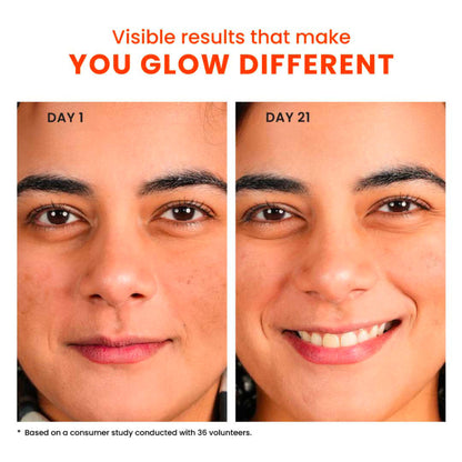 Foxtale 10% Vitamin C-Glutathione Brightening Face Serum For Glowing Skin, Dark Spots & Pigmentation