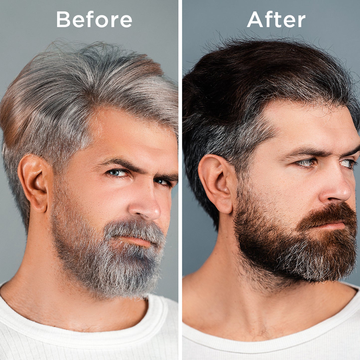 Orgatre Anti Gray Hair Serum With Biotin, Black Seed Oil & Hibiscus Extract