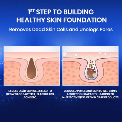 Bio-essence Bio-Renew Exfoliating Gel