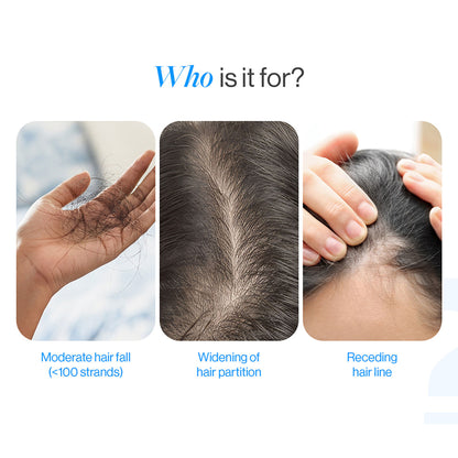 Be Bodywise Hair Growth Serum Roll On - 3% Rosemary, 3% Redensyl & 2% Aminexil For New Hair Growth