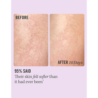 First Aid Beauty KP Bump Eraser Body Scrub With 10% AHA