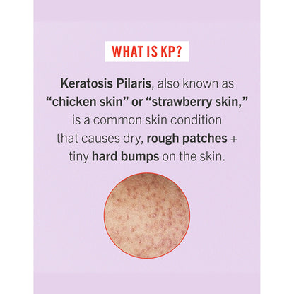 First Aid Beauty KP Bump Eraser Body Scrub With 10% AHA