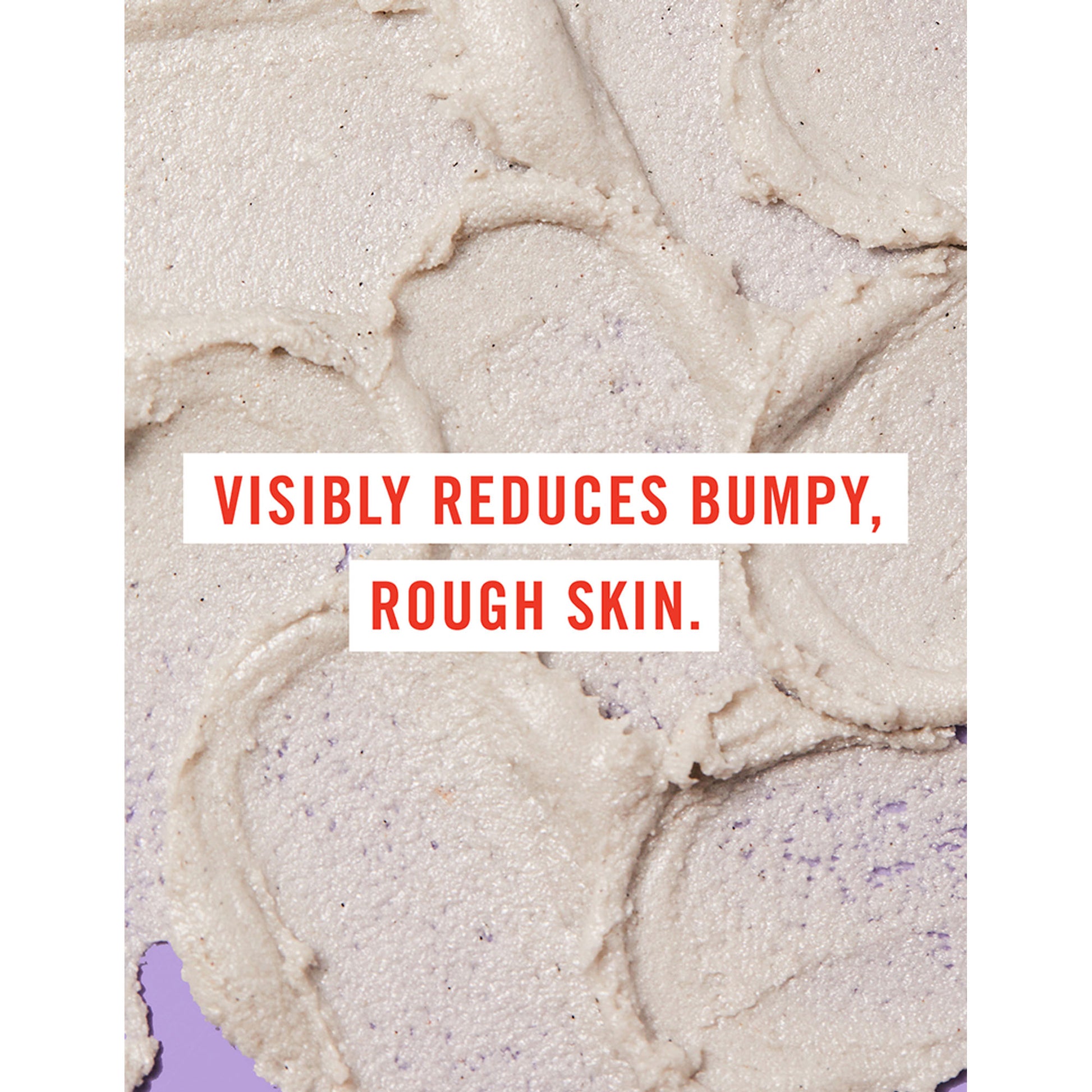 First Aid Beauty KP Bump Eraser Body Scrub With 10% AHA